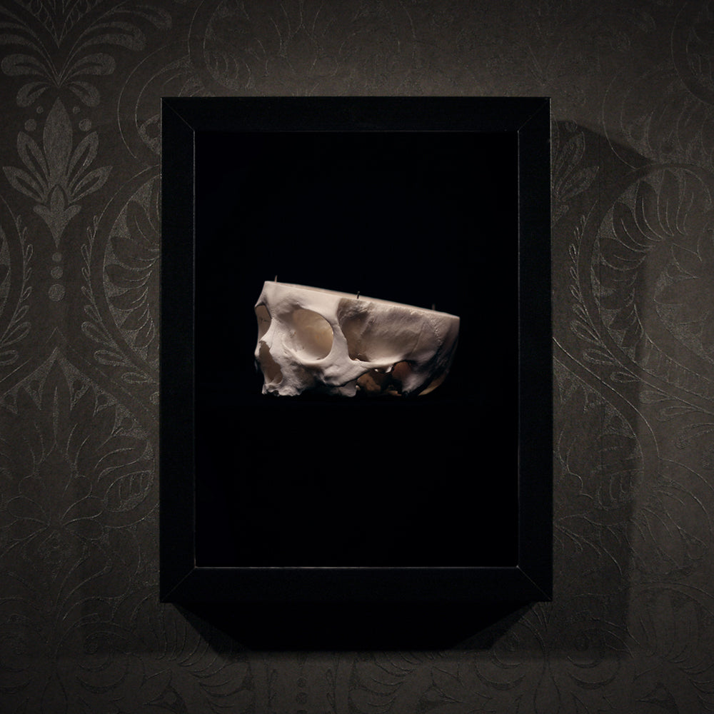 Cut skull, real human skull photography - Framed poster