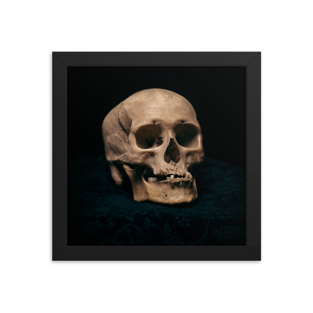 Skull with skewed jaw, real human skull photography - Square framed poster