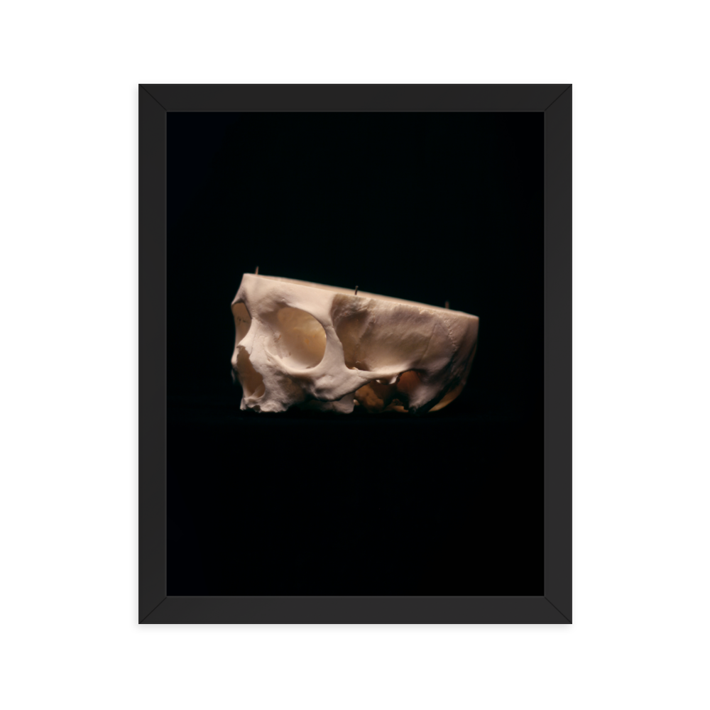 Cut skull, real human skull photography - Framed poster