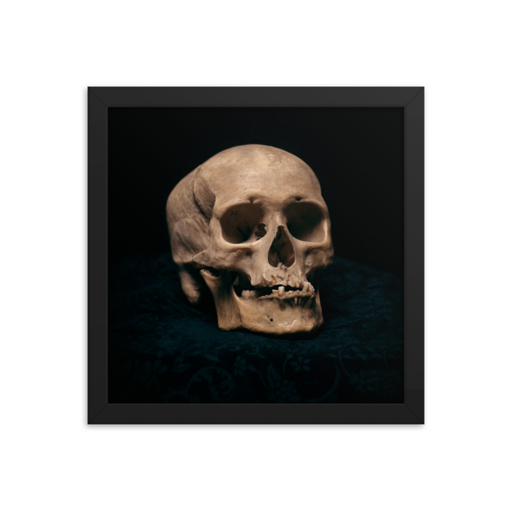 Skull with skewed jaw, real human skull photography - Square framed poster