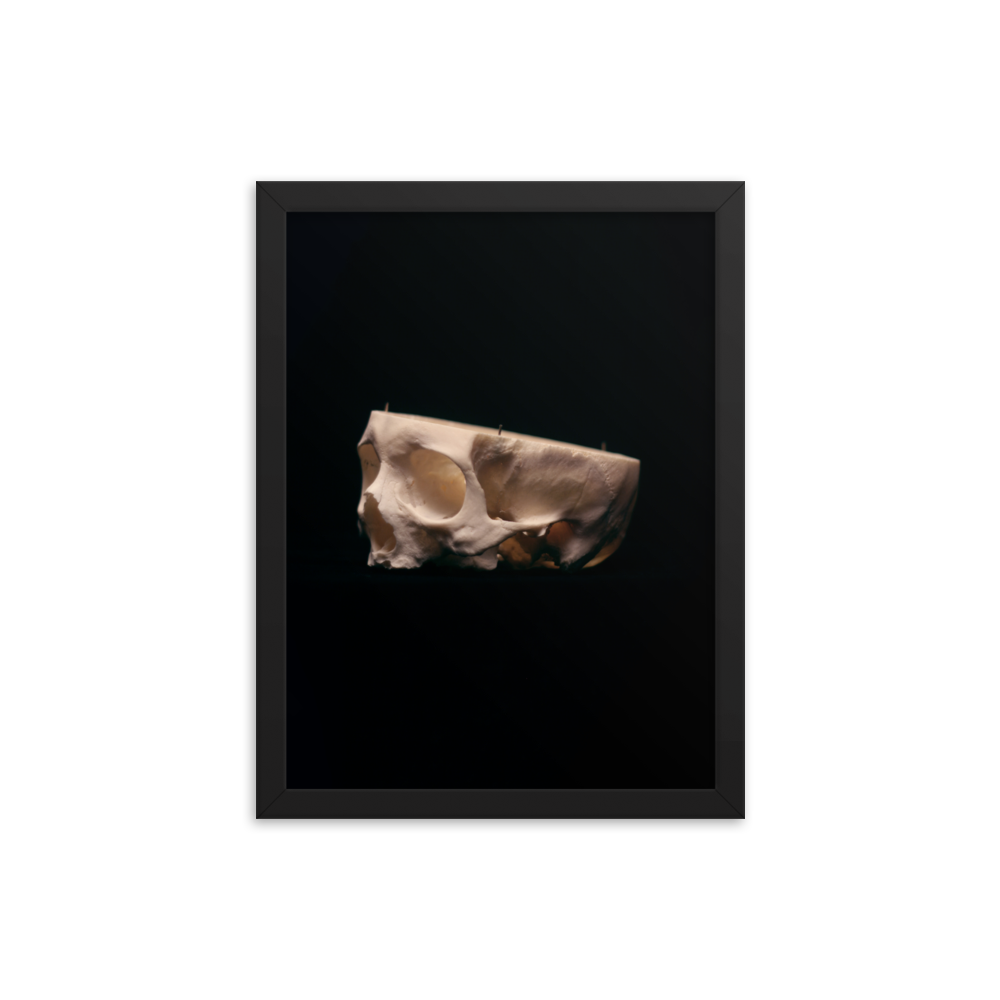 Cut skull, real human skull photography - Framed poster