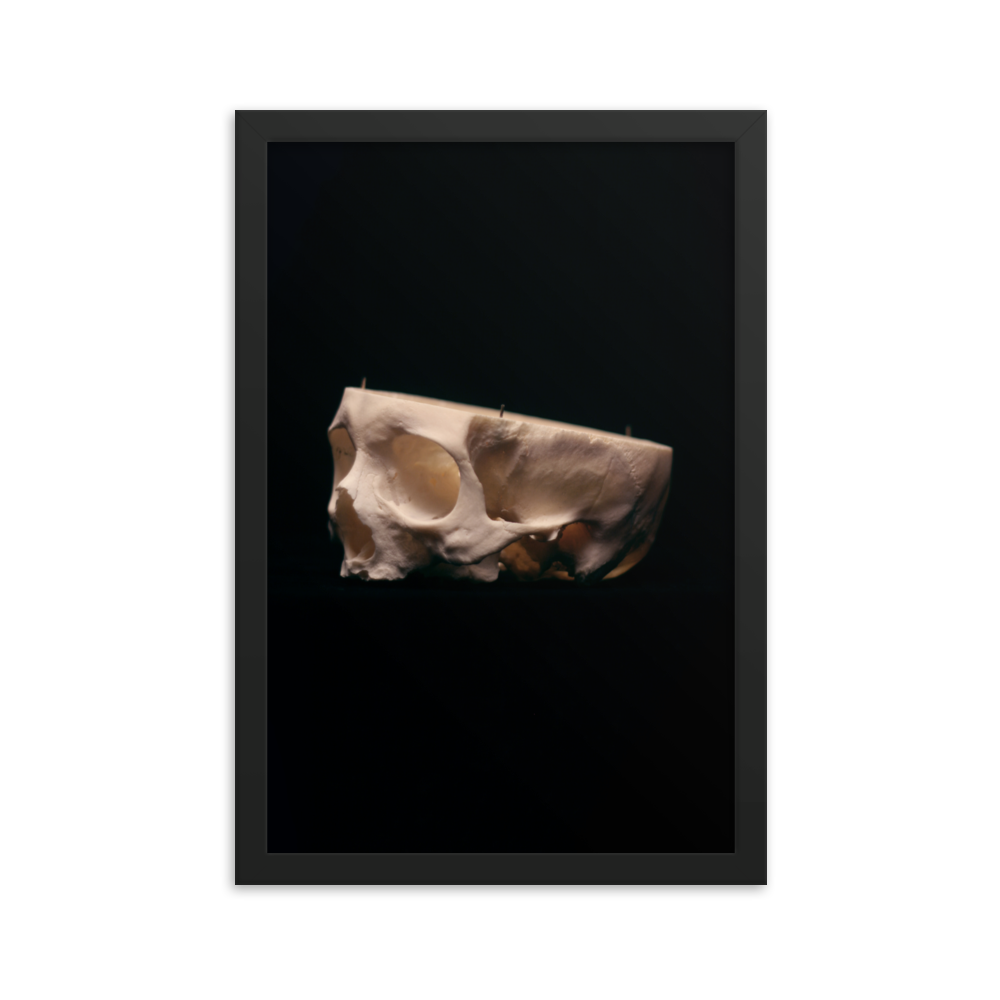 Cut skull, real human skull photography - Framed poster