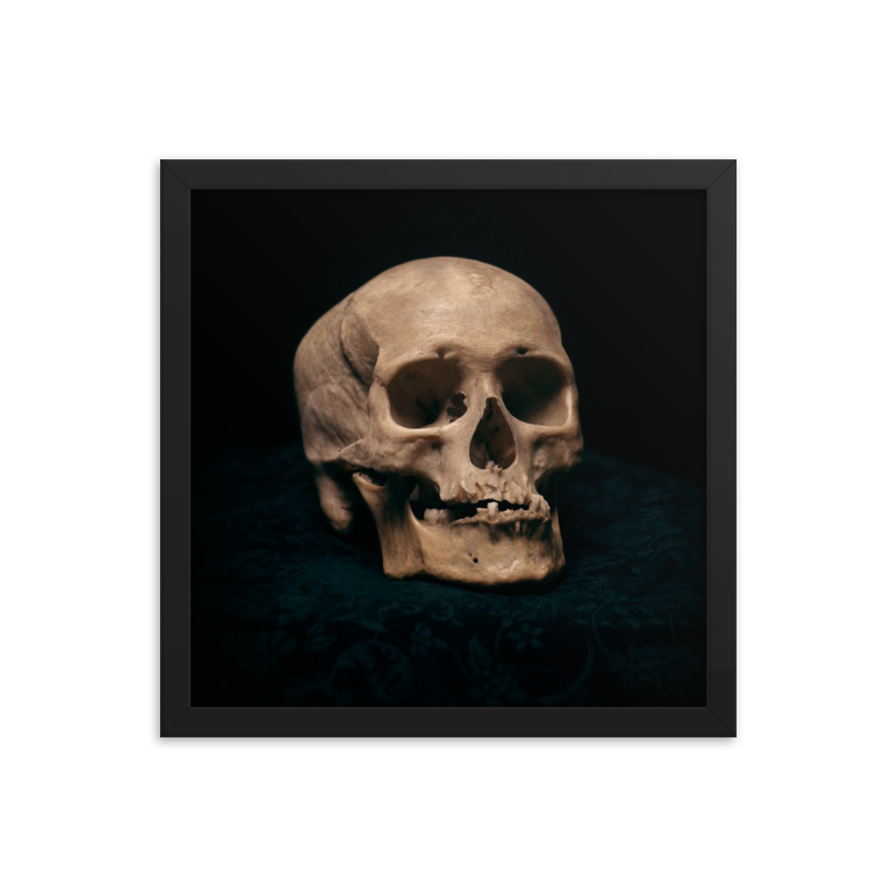 Skull with skewed jaw, real human skull photography - Square framed poster