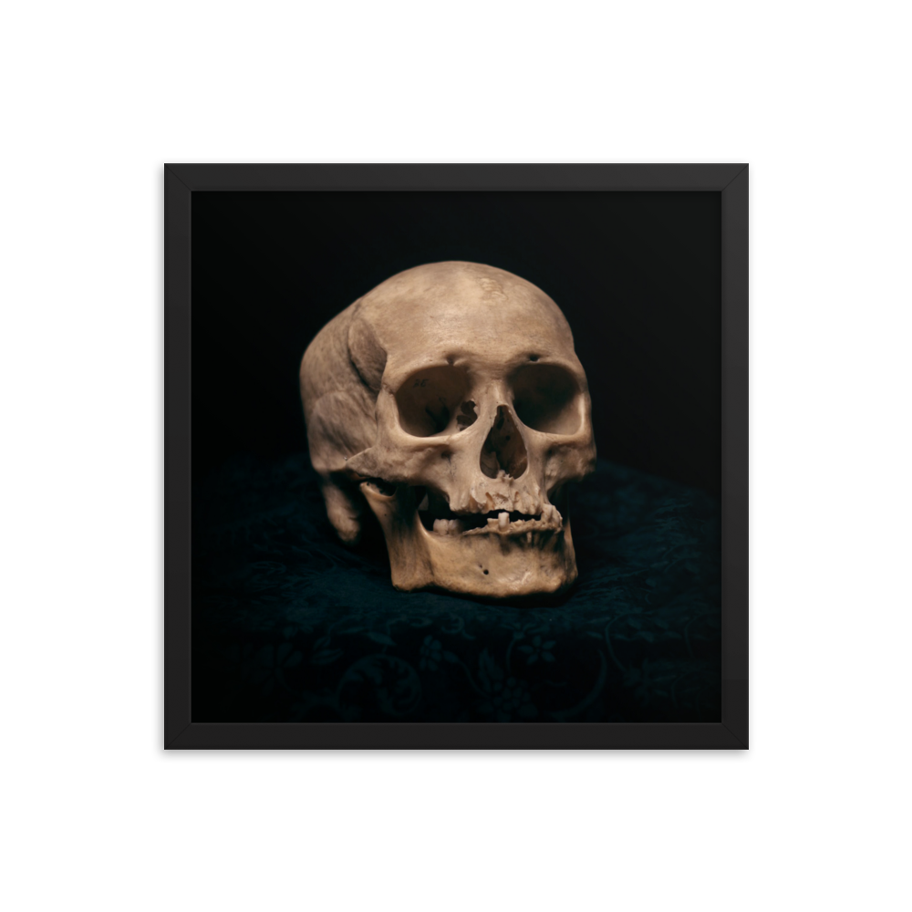 Skull with skewed jaw, real human skull photography - Square framed poster