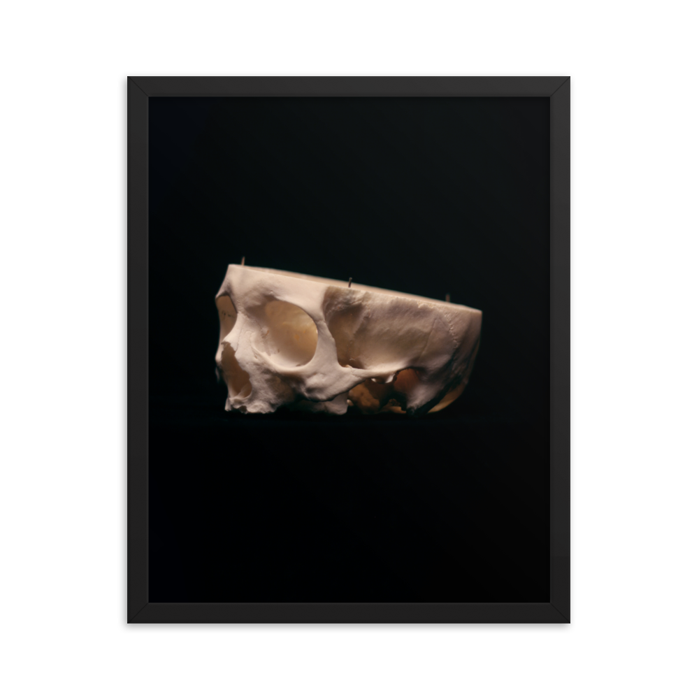 Cut skull, real human skull photography - Framed poster