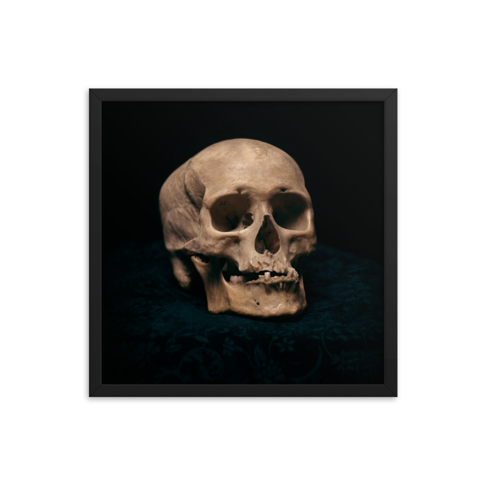 Skull with skewed jaw, real human skull photography - Square framed poster