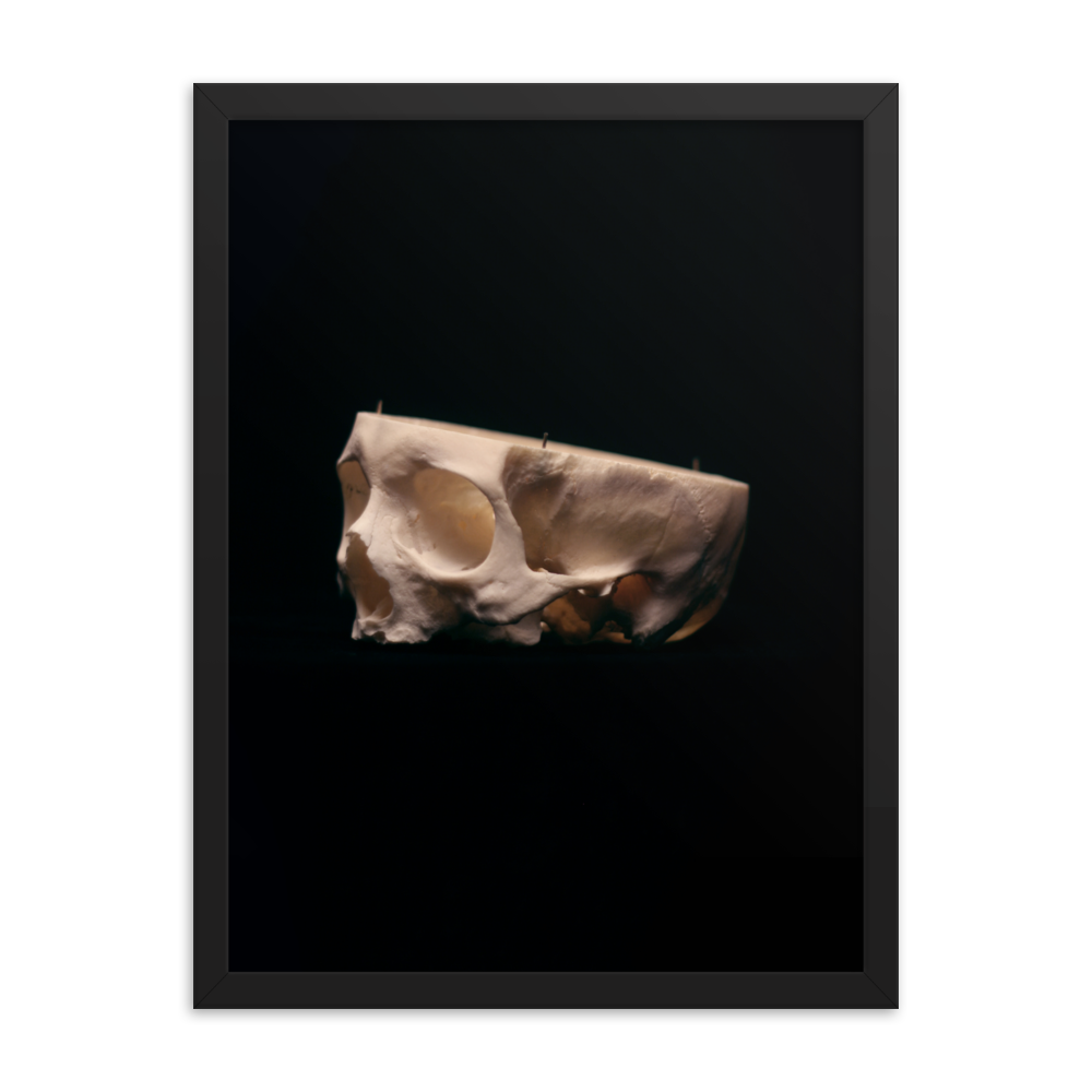 Cut skull, real human skull photography - Framed poster