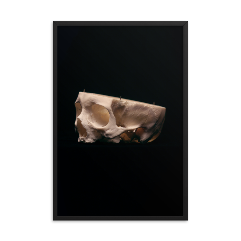 Cut skull, real human skull photography - Framed poster