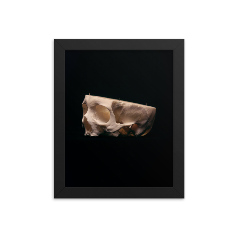 Cut skull, real human skull photography - Framed poster