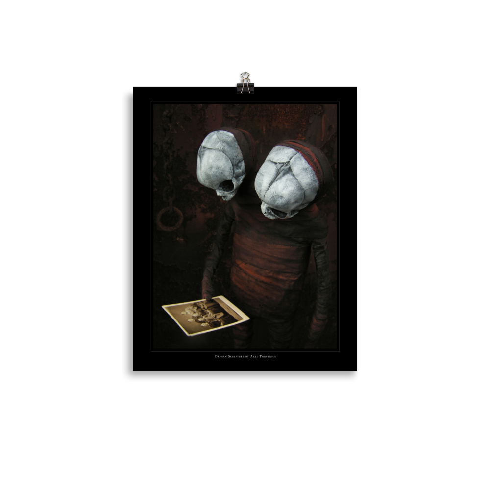 Orphan sculpture, co-joined siamese twin doll - Art print