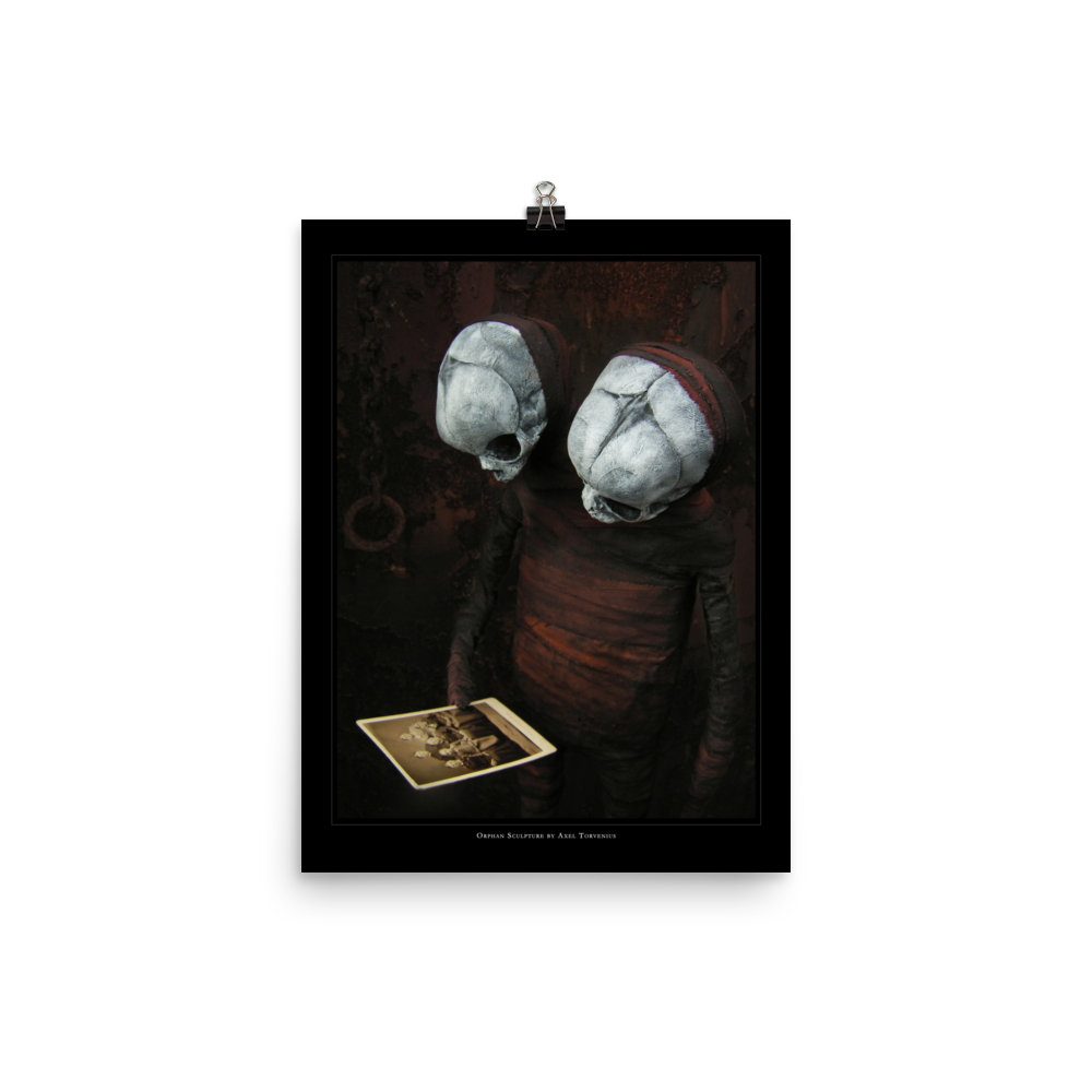 Orphan sculpture, co-joined siamese twin doll - Art print