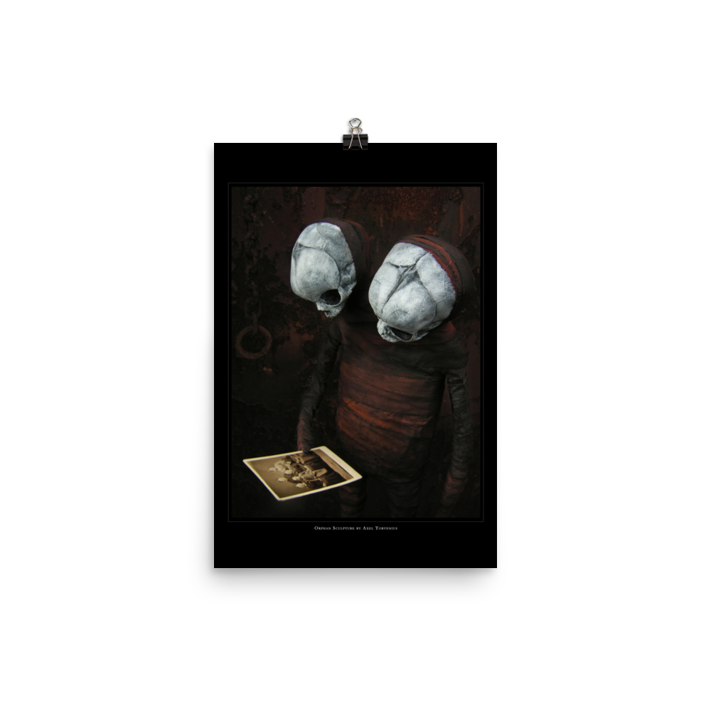 Orphan sculpture, co-joined siamese twin doll - Art print