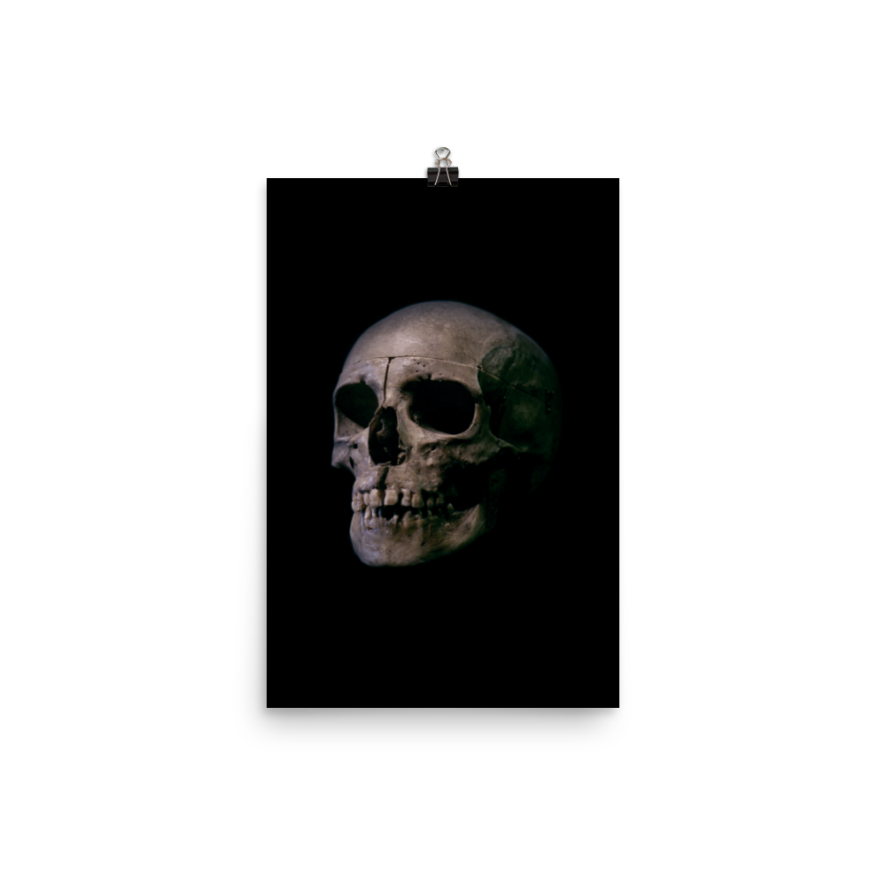 Human skull medical specimen side view - Art print