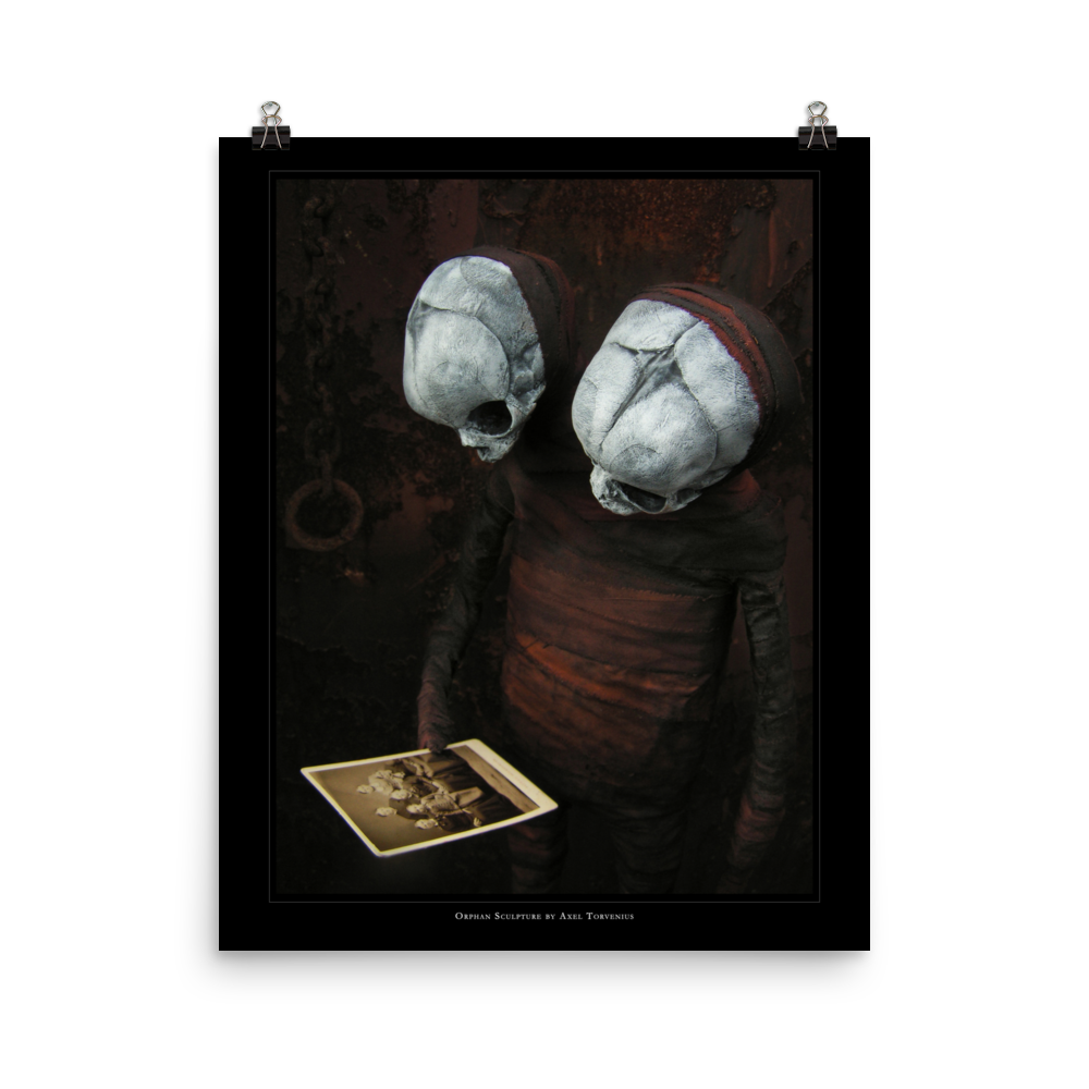 Orphan sculpture, co-joined siamese twin doll - Art print