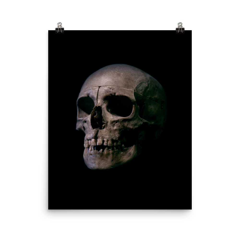 Human skull medical specimen side view - Art print