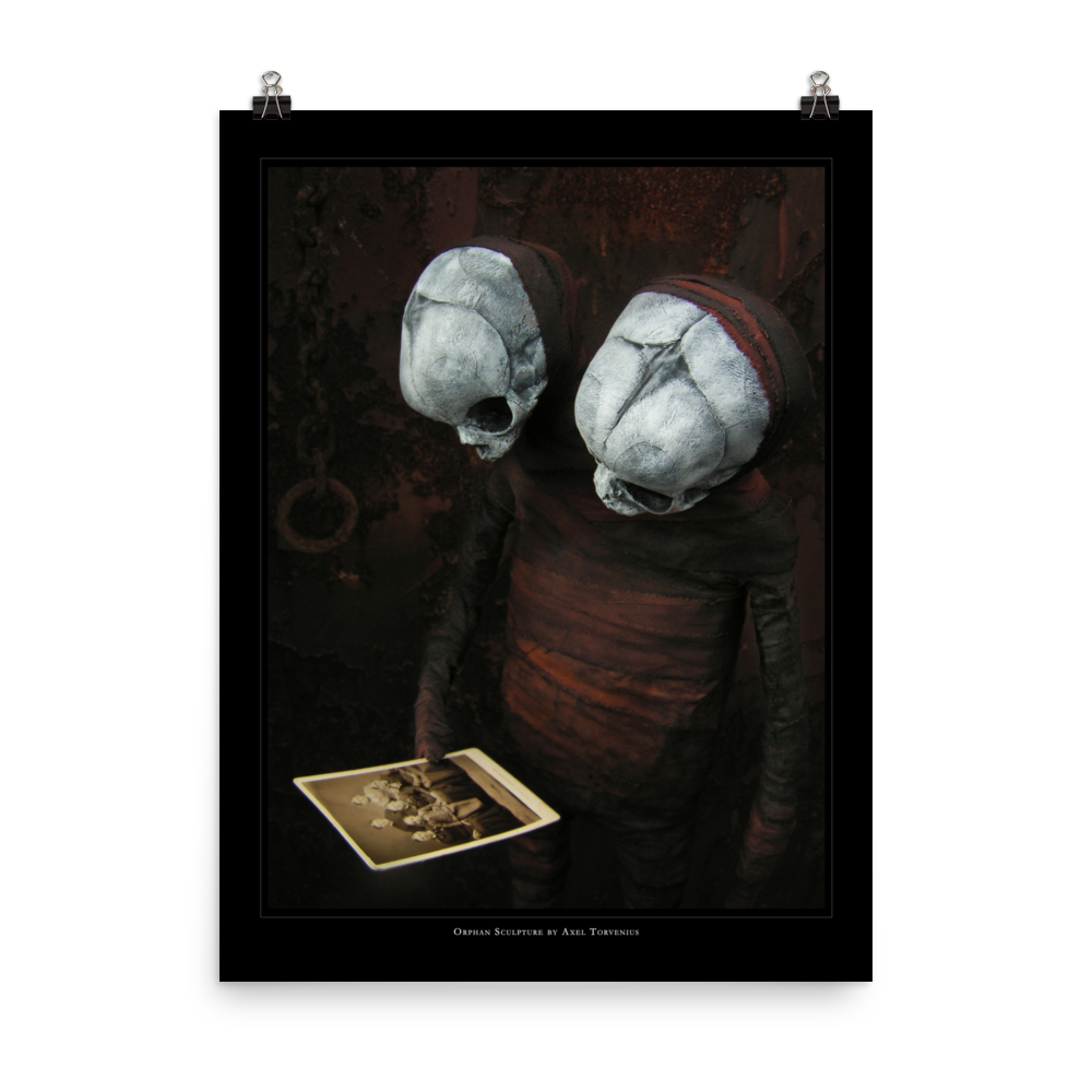 Orphan sculpture, co-joined siamese twin doll - Art print