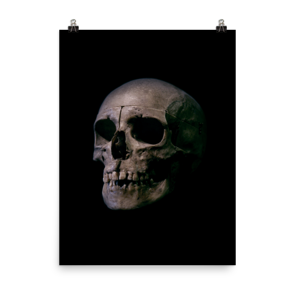 Human skull medical specimen side view - Art print