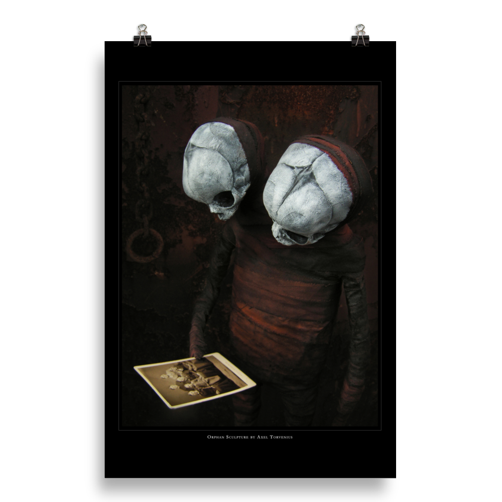 Orphan sculpture, co-joined siamese twin doll - Art print