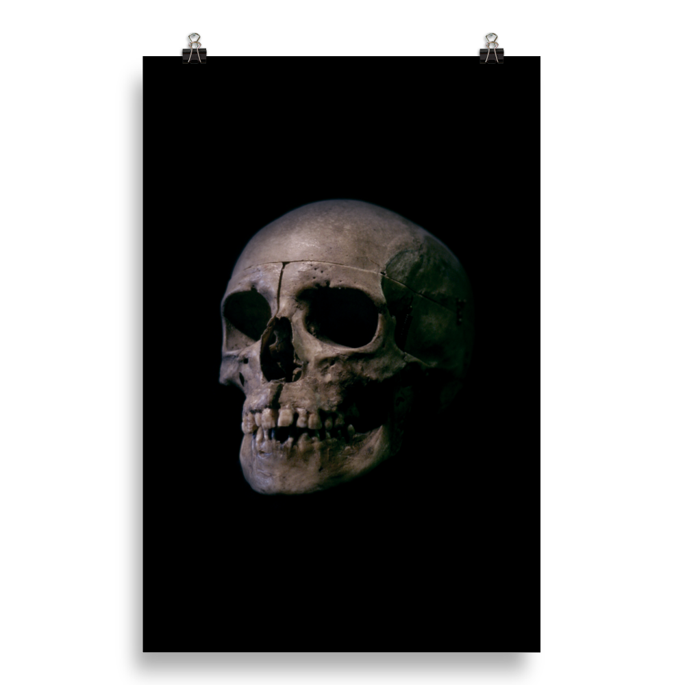 Human skull medical specimen side view - Art print