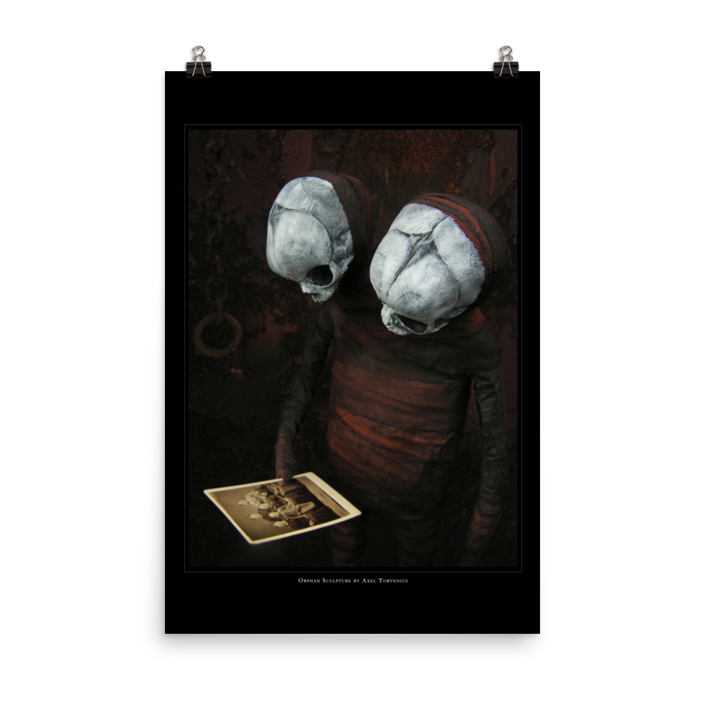 Orphan sculpture, co-joined siamese twin doll - Art print
