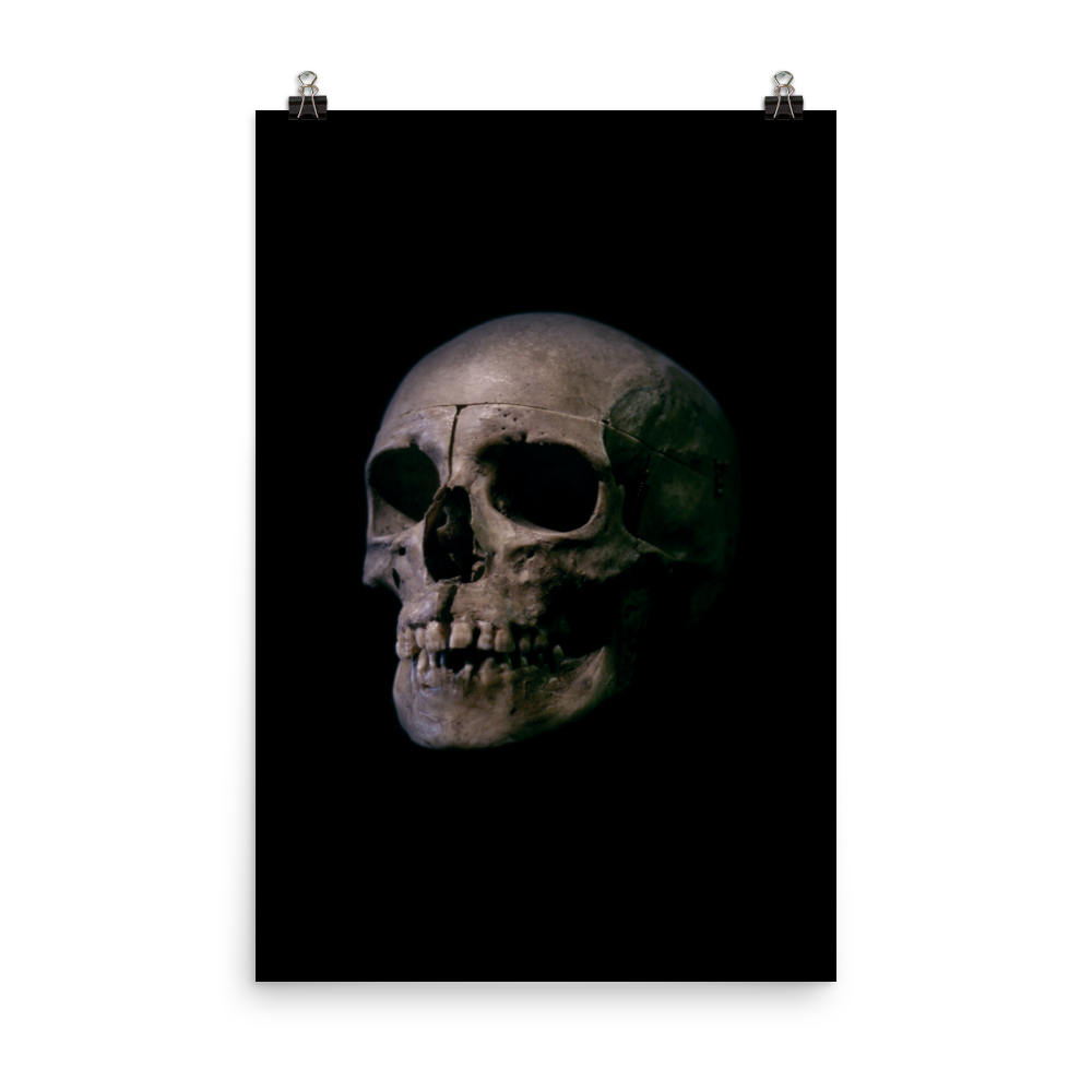 Human skull medical specimen side view - Art print