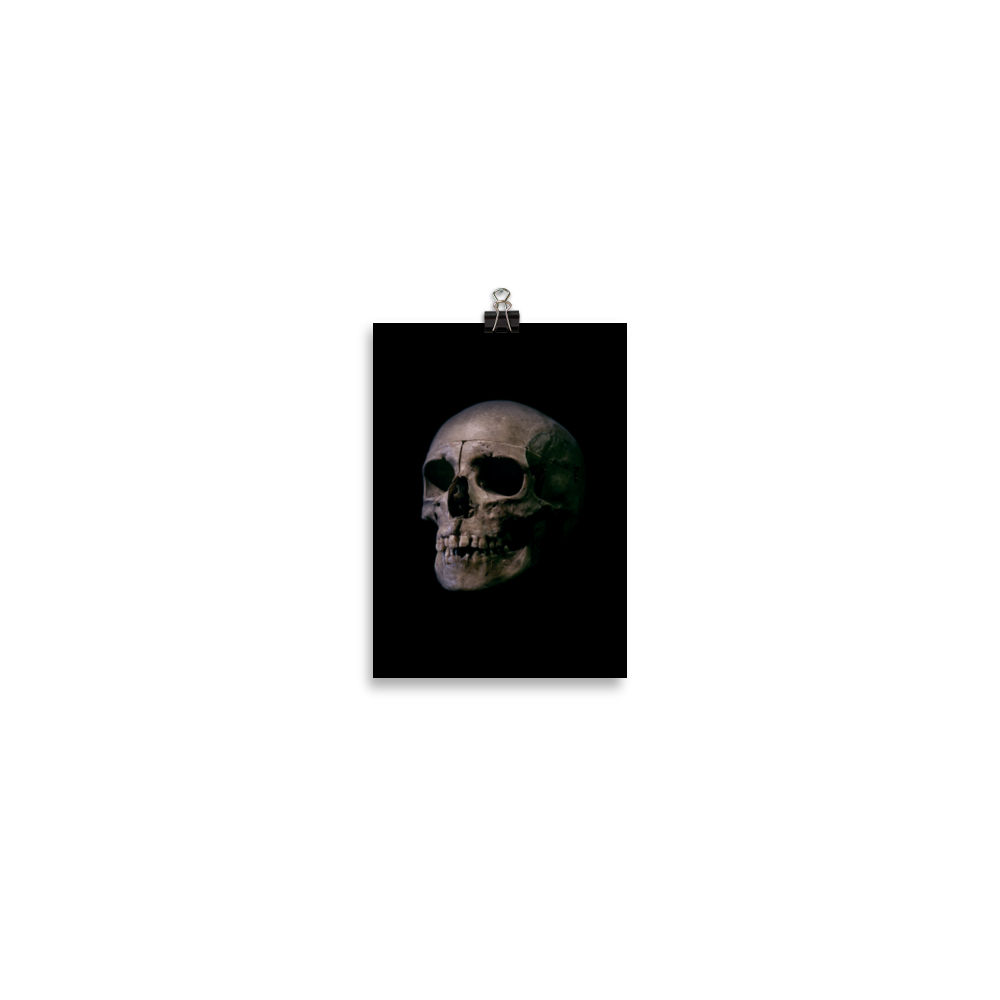 Human skull medical specimen side view - Art print