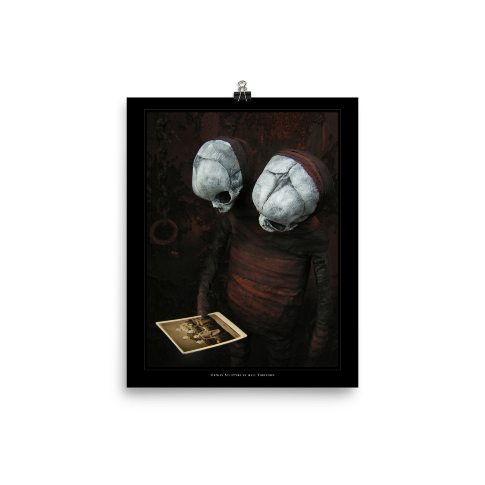 Orphan sculpture, co-joined siamese twin doll - Art print