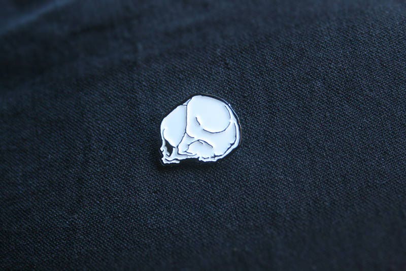 Fetal skull, dead fetus - PIN