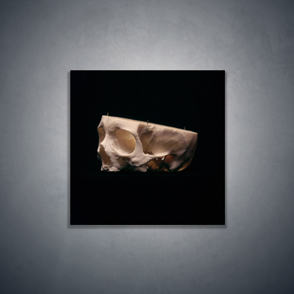 Cut skull, real human skull photography - Square art print