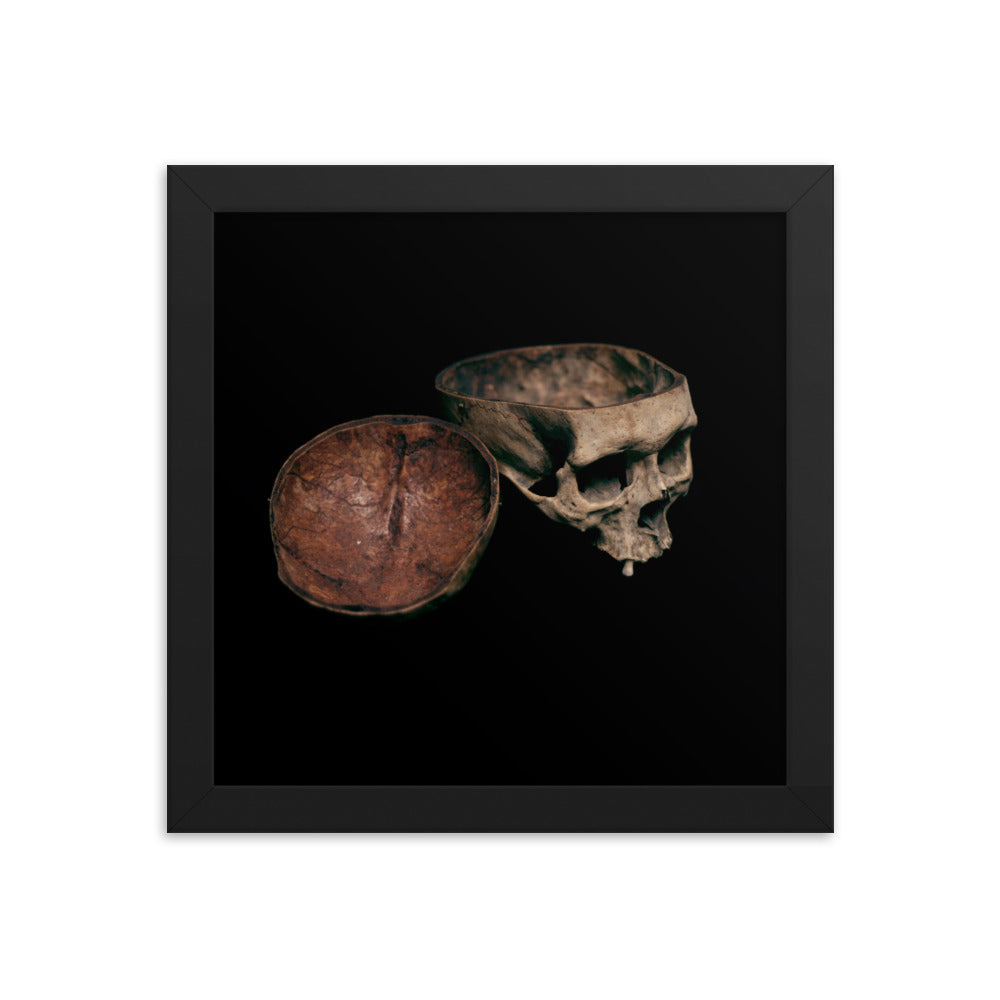 Skull with cut calvarium, real human skull photography - Framed poster