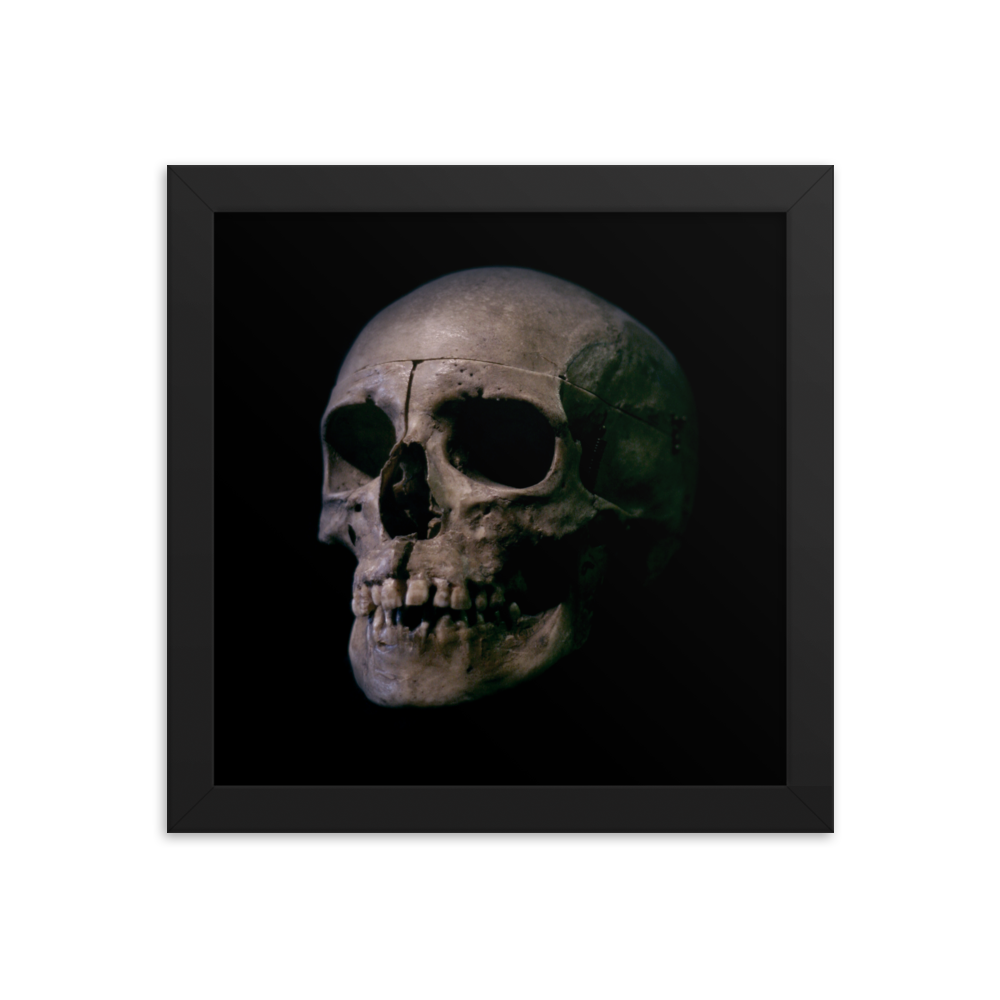 Human skull medical specimen side view - Square framed poster