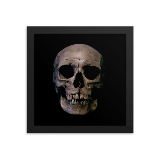 Human skull medical specimen front view - Square framed poster