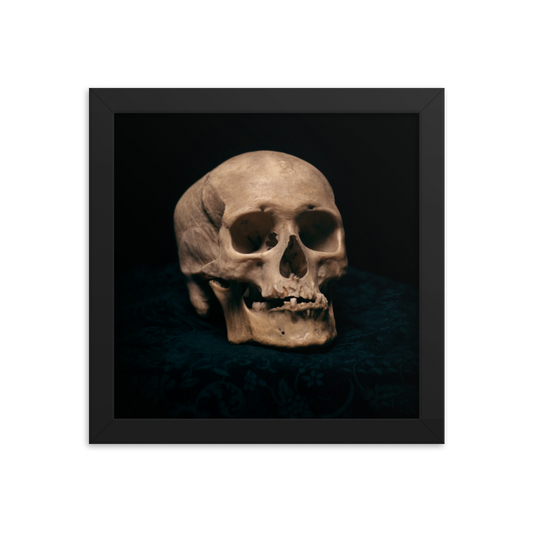 Skull with skewed jaw, real human skull photography - Square framed poster