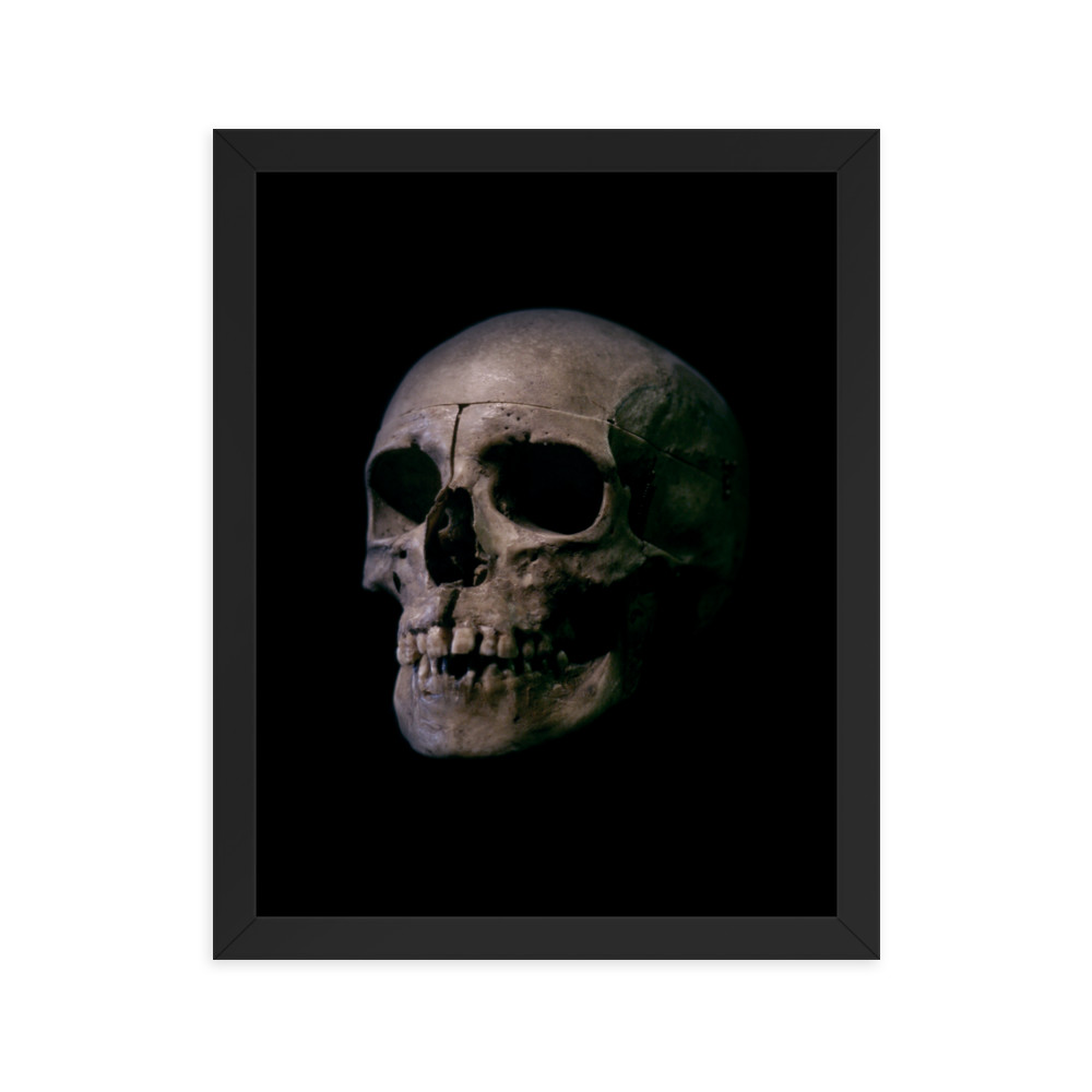 Human skull medical specimen side view - Framed poster