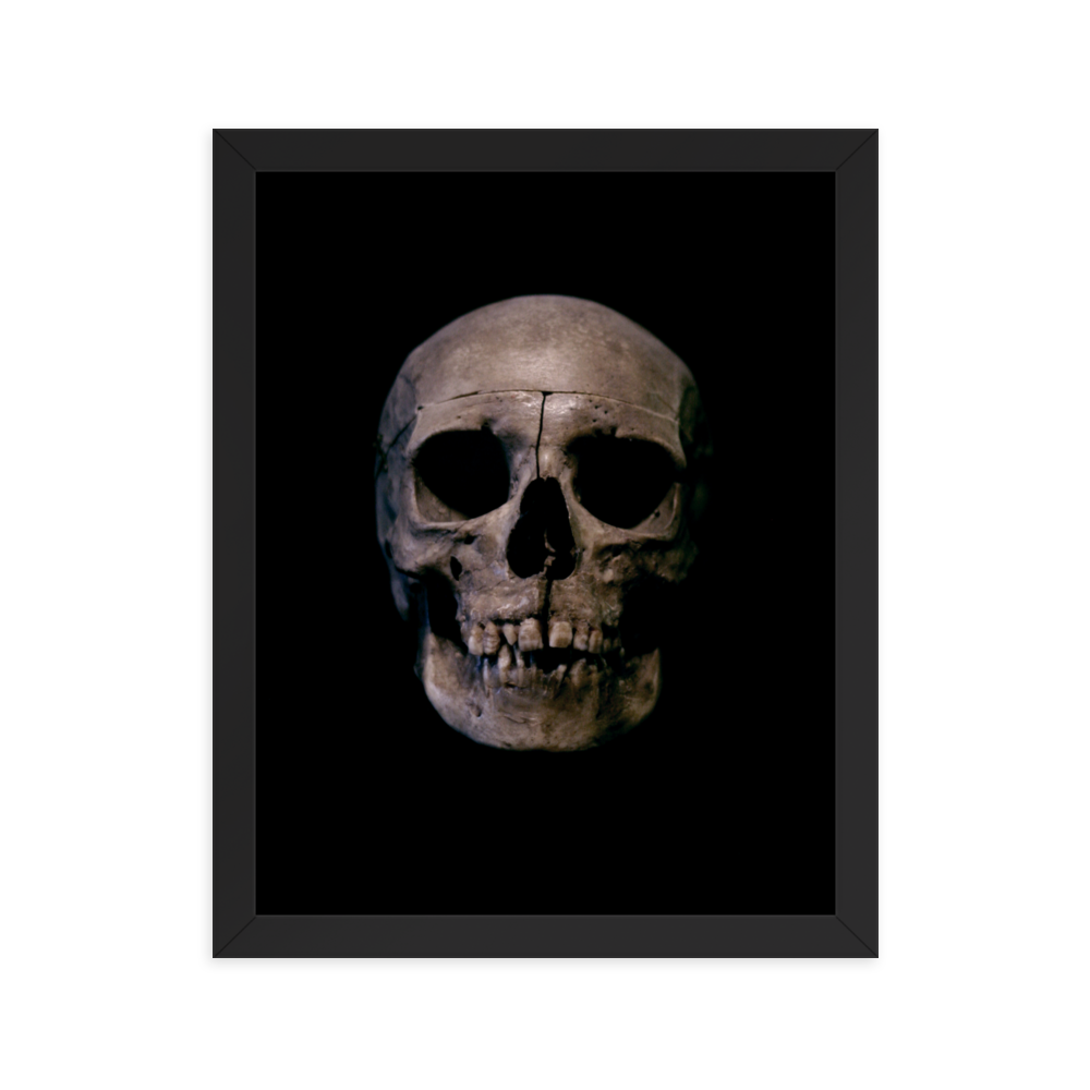 Human skull medical specimen front view - Framed poster