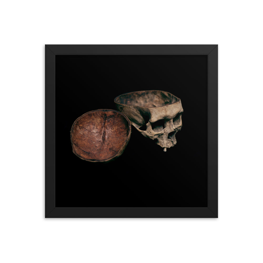 Skull with cut calvarium, real human skull photography - Framed poster