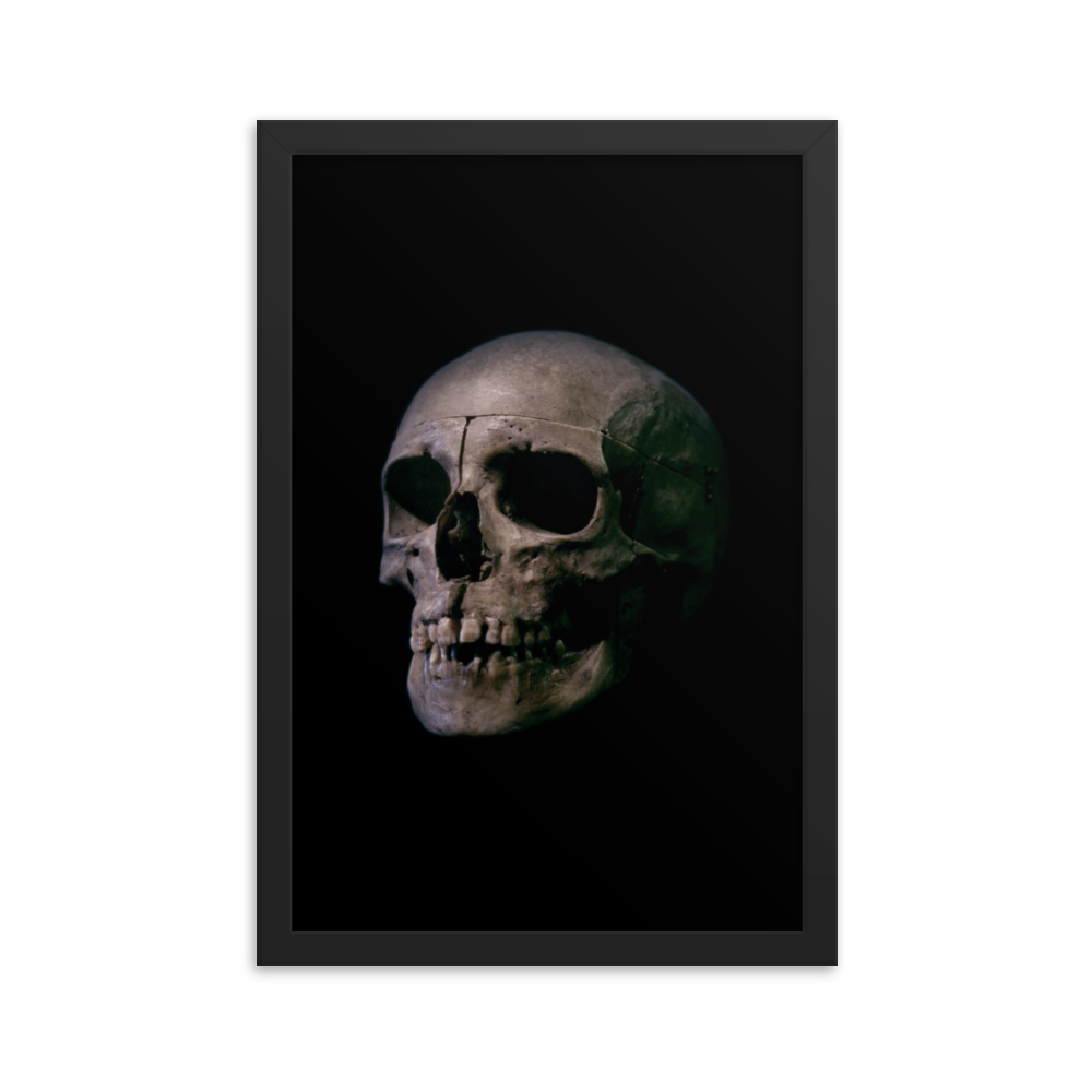 Human skull medical specimen side view - Framed poster