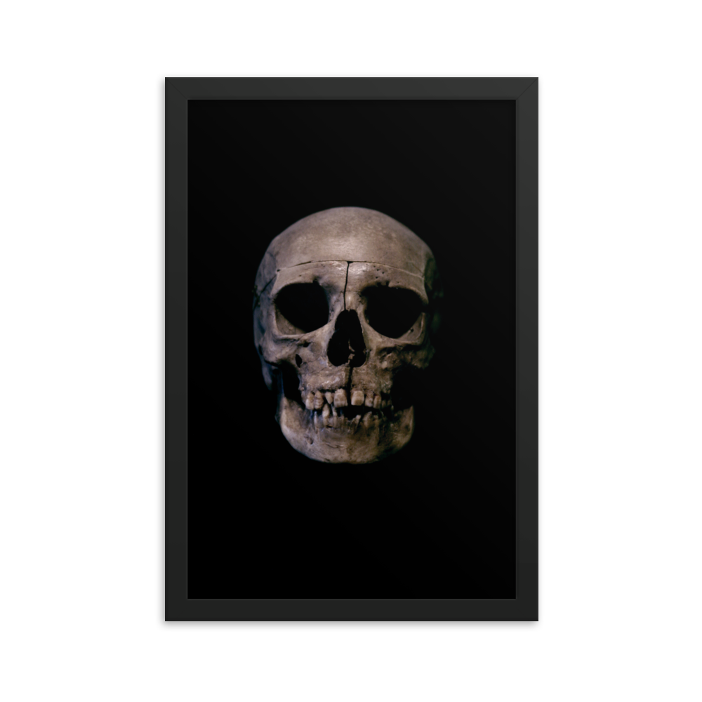 Human skull medical specimen front view - Framed poster