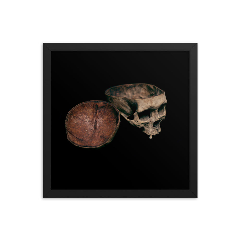 Skull with cut calvarium, real human skull photography - Framed poster