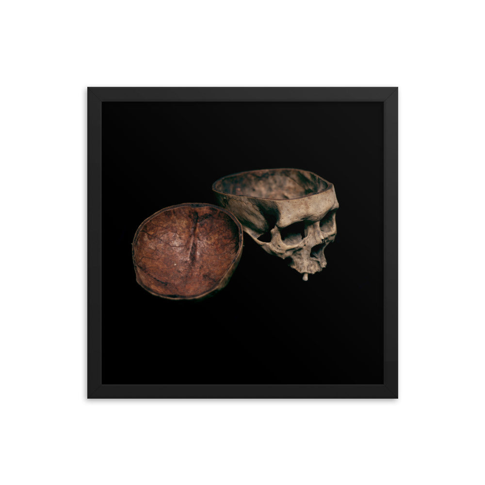 Skull with cut calvarium, real human skull photography - Framed poster