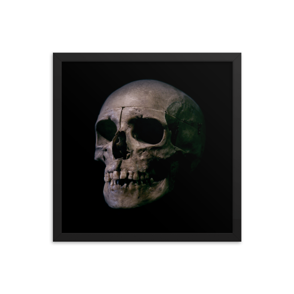 Human skull medical specimen side view - Square framed poster