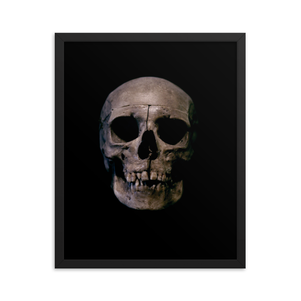 Human skull medical specimen front view - Framed poster