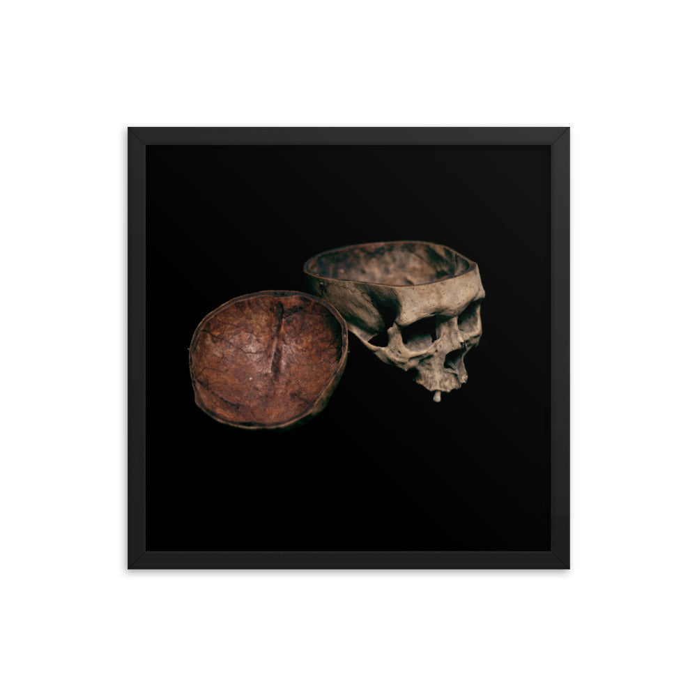 Skull with cut calvarium, real human skull photography - Framed poster