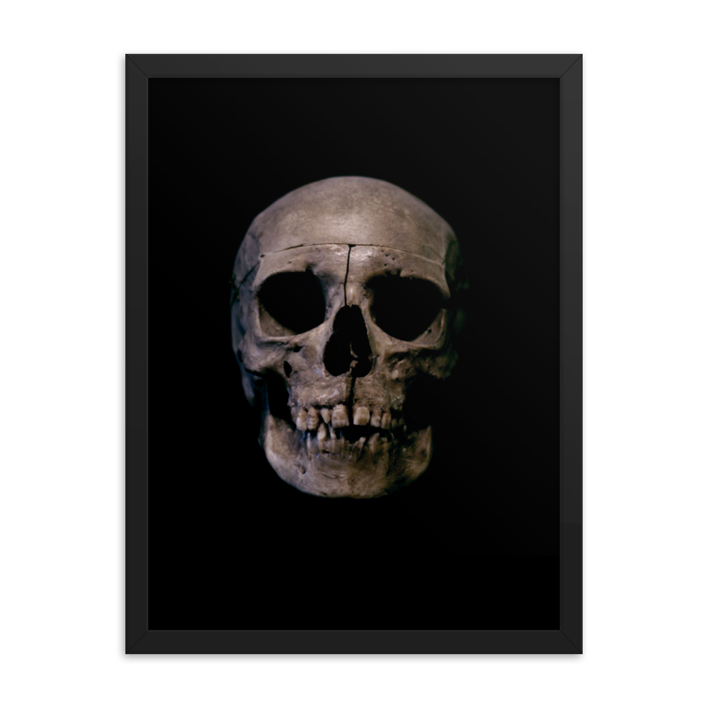 Human skull medical specimen front view - Framed poster