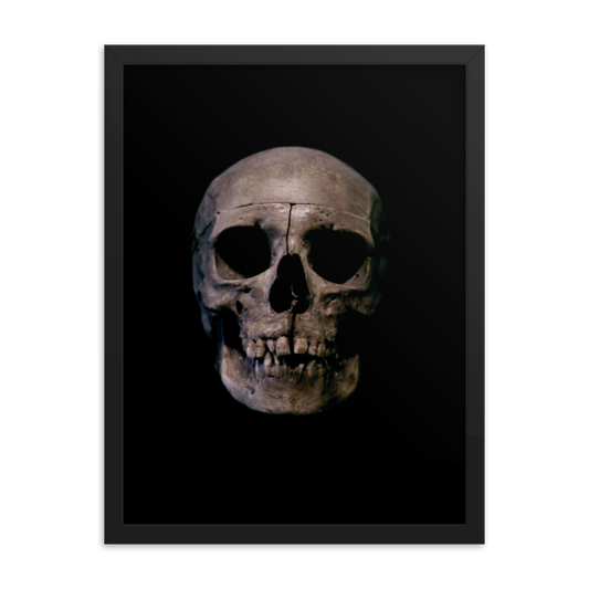 Human skull medical specimen front view - Framed poster