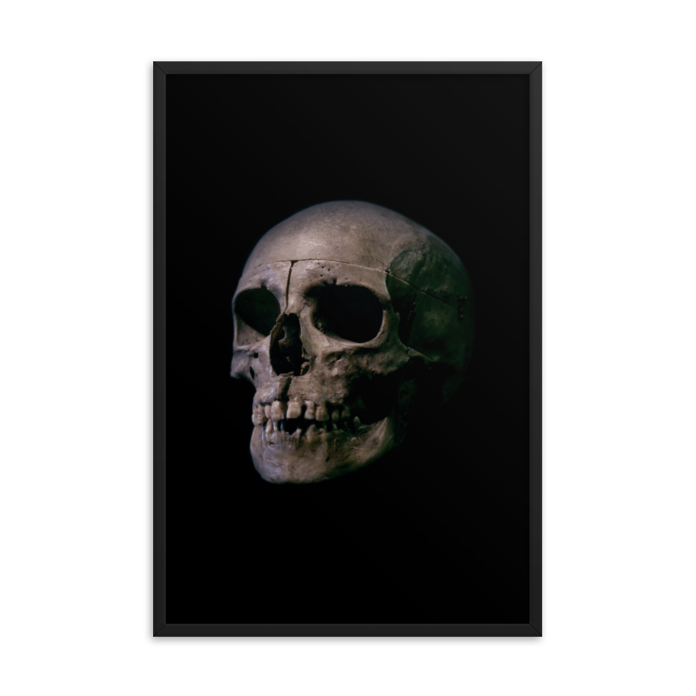 Human skull medical specimen side view - Framed poster