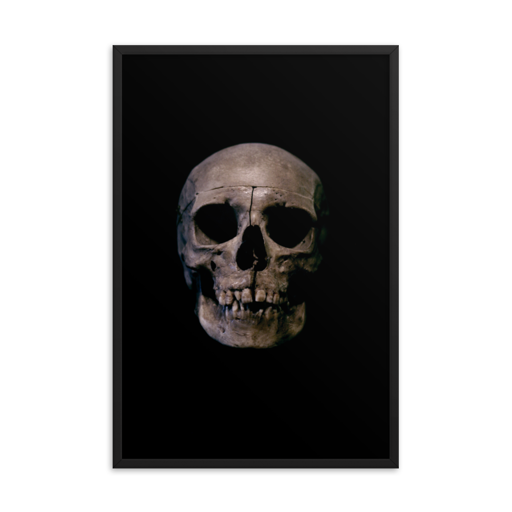 Human skull medical specimen front view - Framed poster