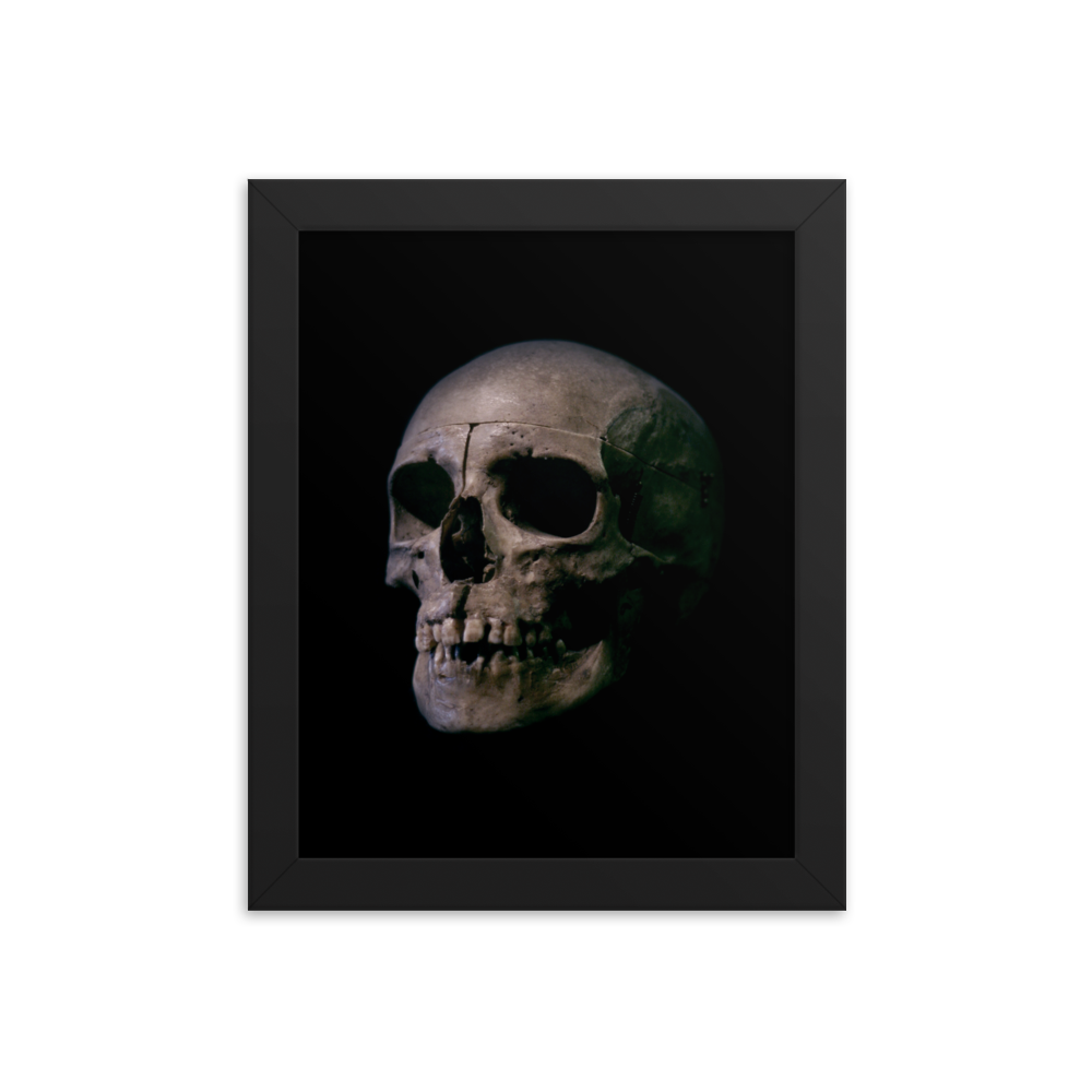 Human skull medical specimen side view - Framed poster