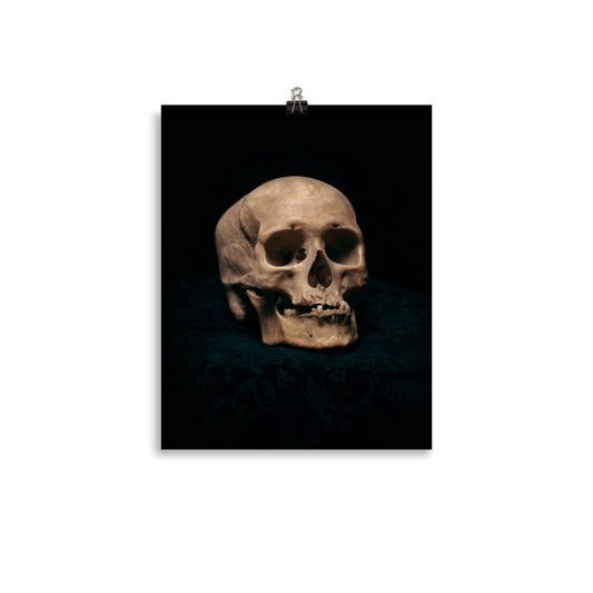 Skull with skewed jaw, real human skull photography - Art print