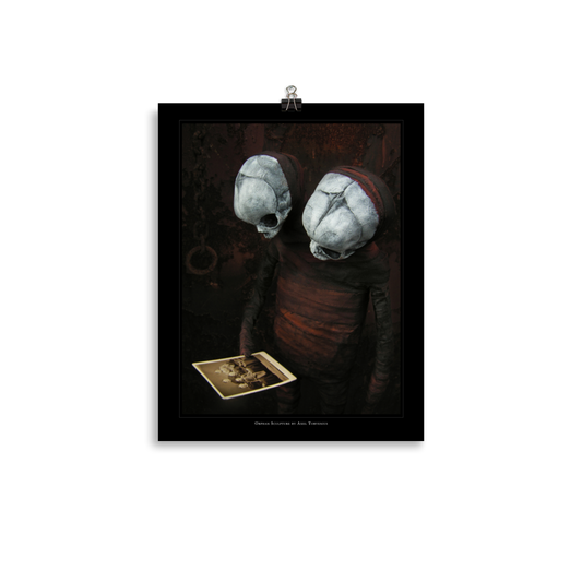 Orphan sculpture, co-joined siamese twin doll - Art print